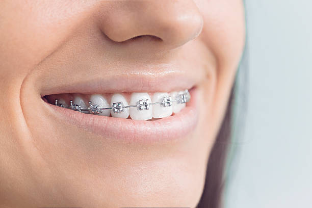 Why Choose Us for Your Dental Needs in Port Orange, FL